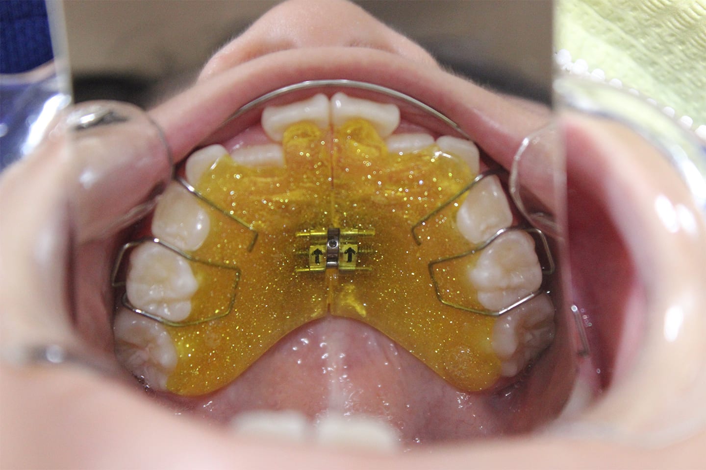 平行写真2(写真10の装置)