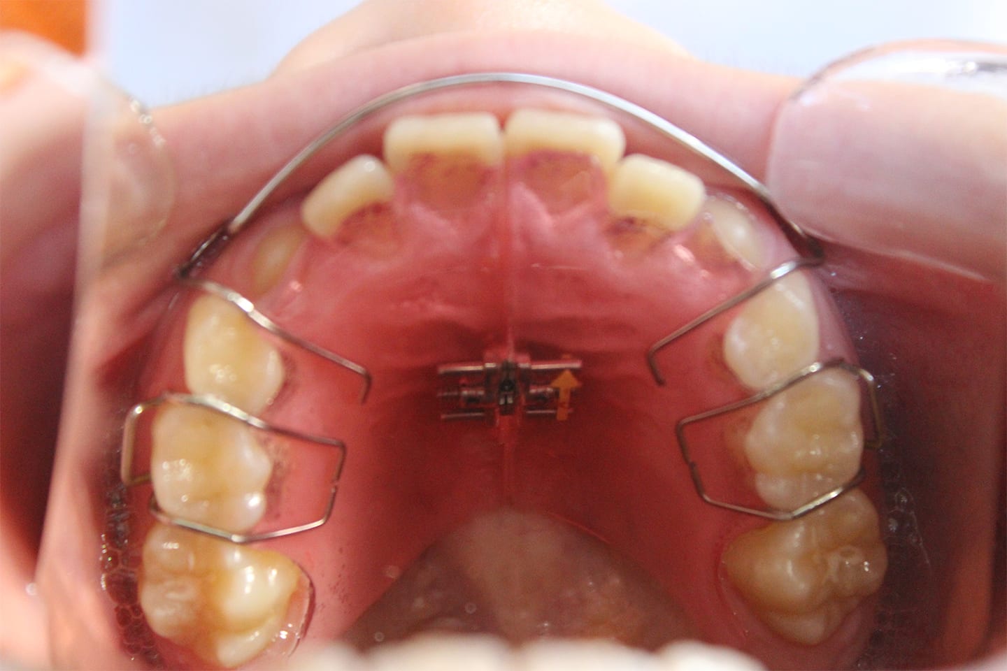 平行写真(写真11の装置)