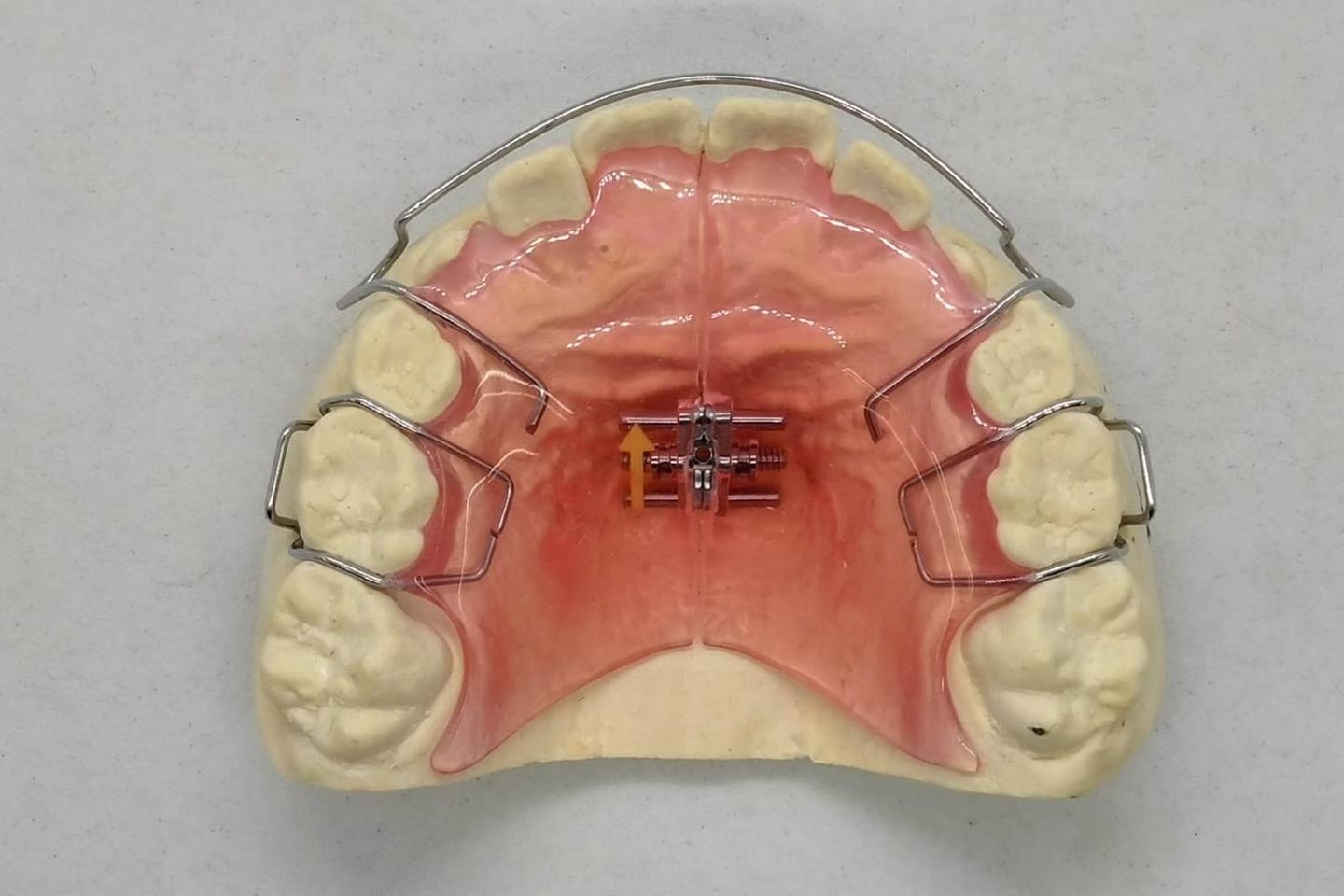 平行写真(写真11の装置)